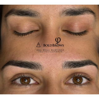 Tratamiento  Microblading